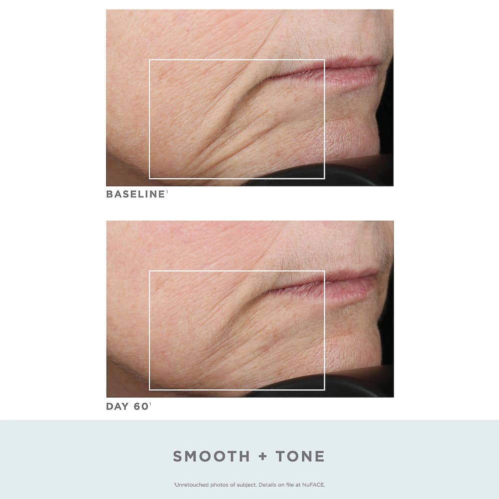 NuFACE Wrinkle Reducer Trinity Attachment from Sephora